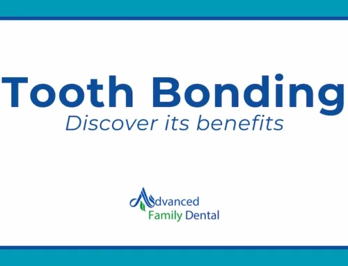 How Tooth Bonding Can Transform Your Smile in Kendall, FL