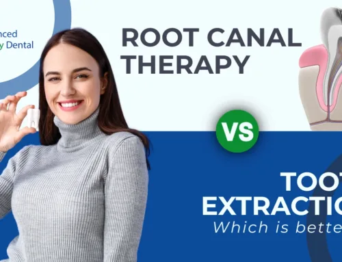 Root Canal Therapy vs. Tooth Extraction: Which One Is the Better Choice for Your Smile? in Kendall, FL