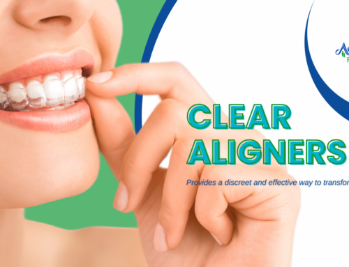Clear Aligners in Kendall, FL
