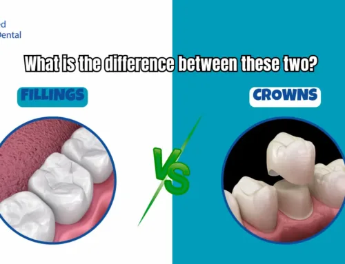 What is the difference between fillings vs crowns in Kendall, FL