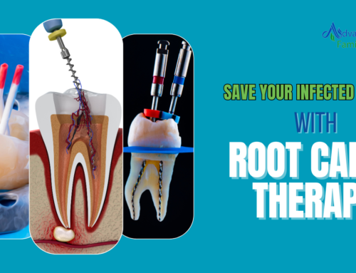 Root Canal in Kendall, FL